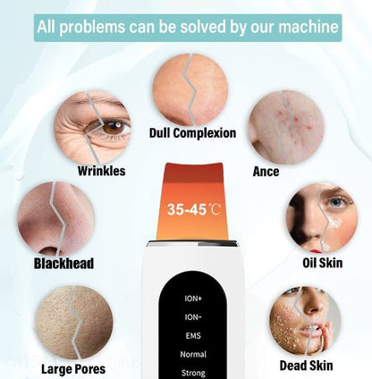 Shovel Skin Blackhead Ultrasonic Beauty - Next Day Delivery