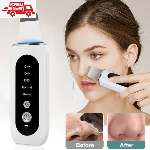Shovel Skin Blackhead Ultrasonic Beauty - Next Day Delivery